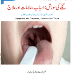 Sore Throat: Causes, Symptoms and Treatment