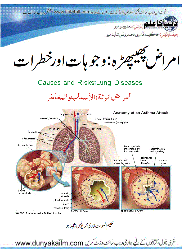 Lung Diseases: Causes and Risks
