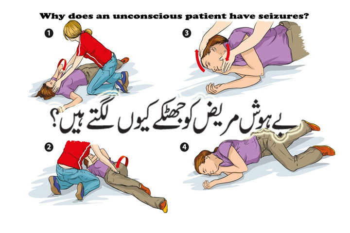 Why does an unconscious patient have seizures?