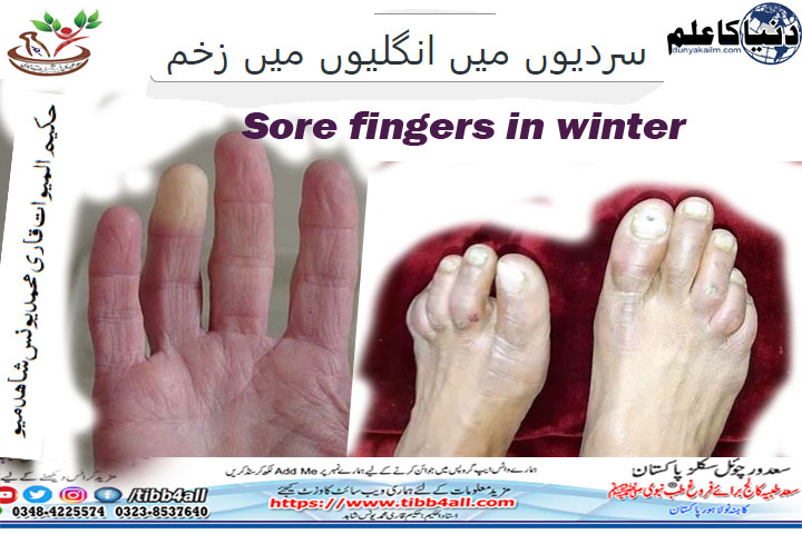 Sore fingers in winter