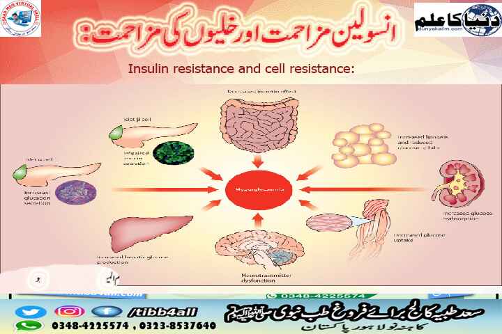 انسولین مزاحمت اور خلیوں کی مزاحمت